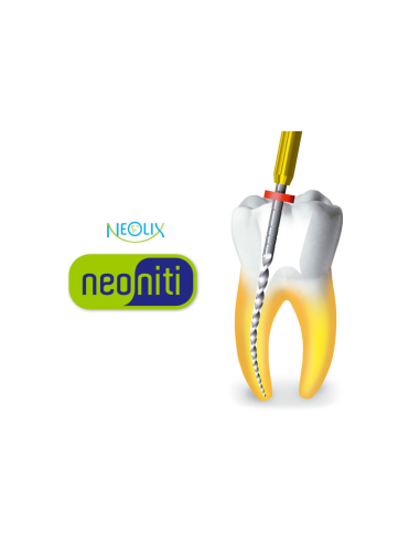 Neoniti Files by Neolix
